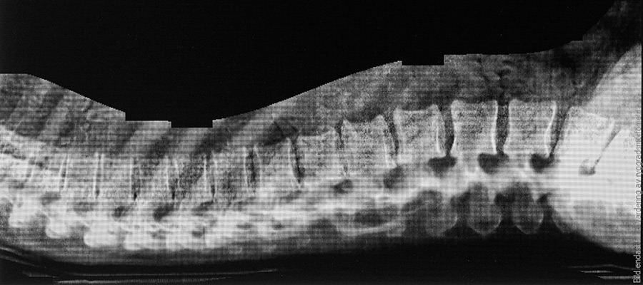Röntgenbild av kotpelare tagen med den nya utrustningen